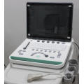 Laptop de la máquina de ultrasonido para la clínica